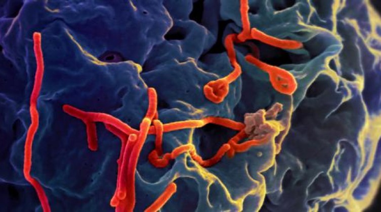 ما_هو_مرض_الإيبولا