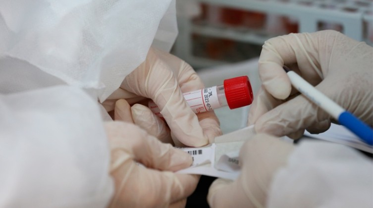 coronna21-1632120540