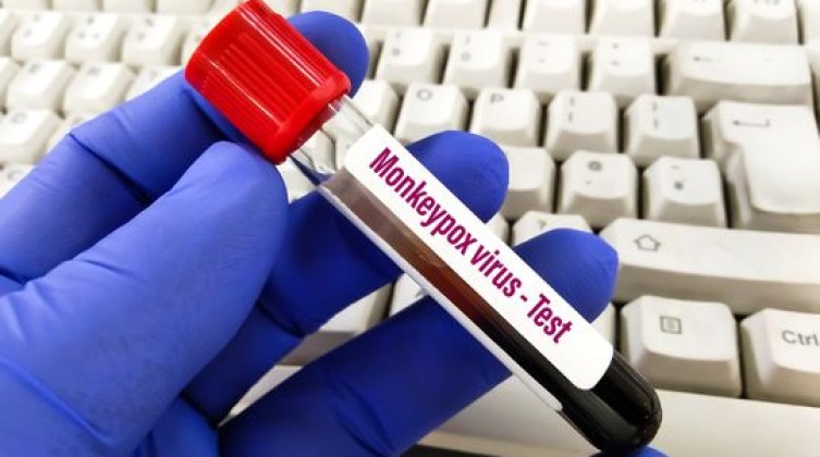 Monkeypox_180e1b374c2_medium