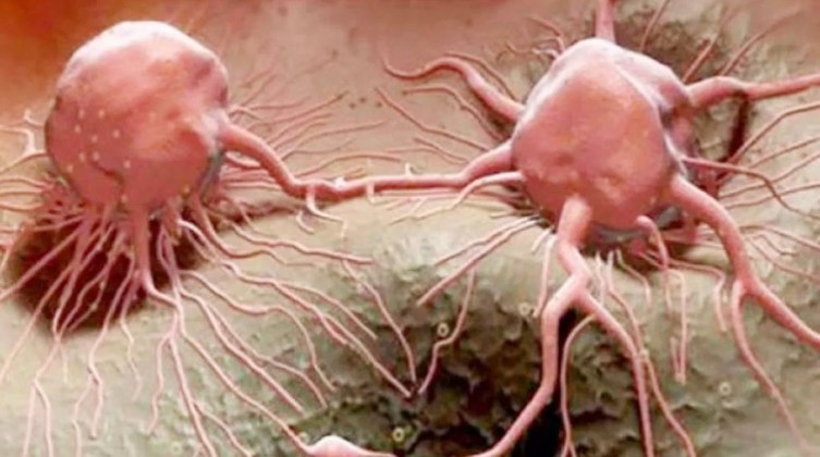 2d82dae4-a8b7-4108-9d56-06a76e214a74