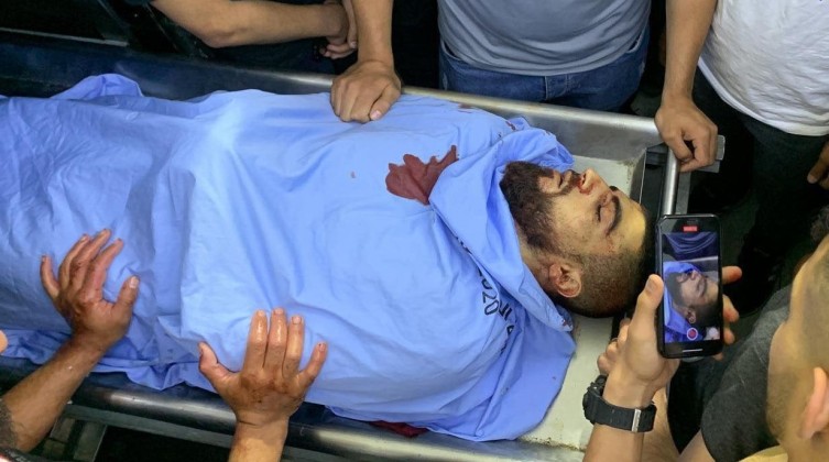 بالصور والفيديو: شهيد وإصابات خطيرة خلال اقتحام الاحتلال بلدة يعبد غرب جنين