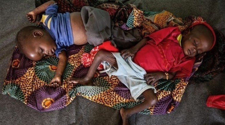 157 وفاة وألفين إصابة بفيروس بالحصبة في زيمبابوي