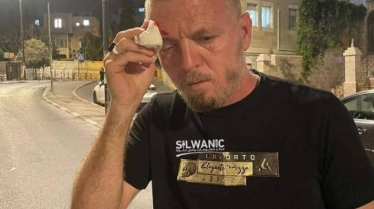 المستوطنون يعتدون على مقدسي بالضرب
