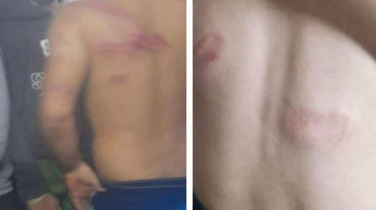مجهولون يعتدون على عمال فلسطينيين بعد اختطافهم في الداخل المحتل