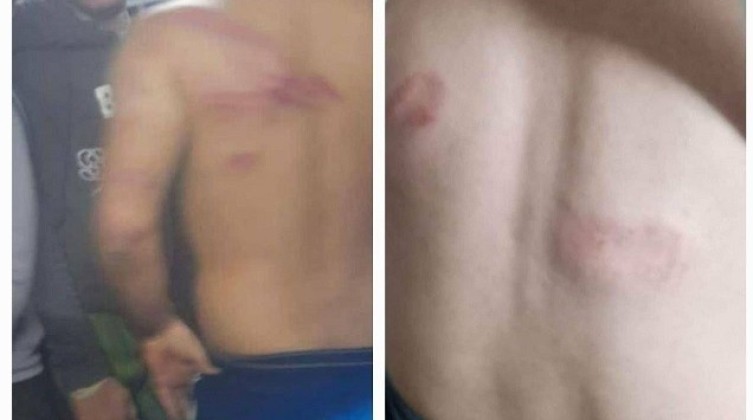الكشف عن تفاصيل اختطاف عمال فلسطينيين في الجليل الأعلى