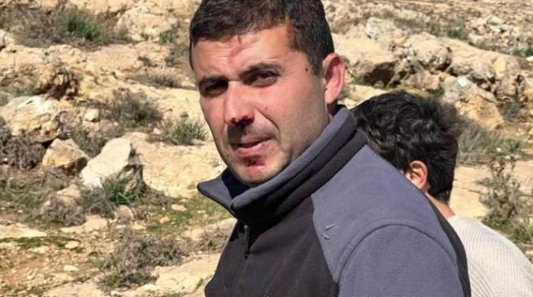 إصابة مواطن ونجله بجروح في اعتداء للمستوطنين بمسافر يطا