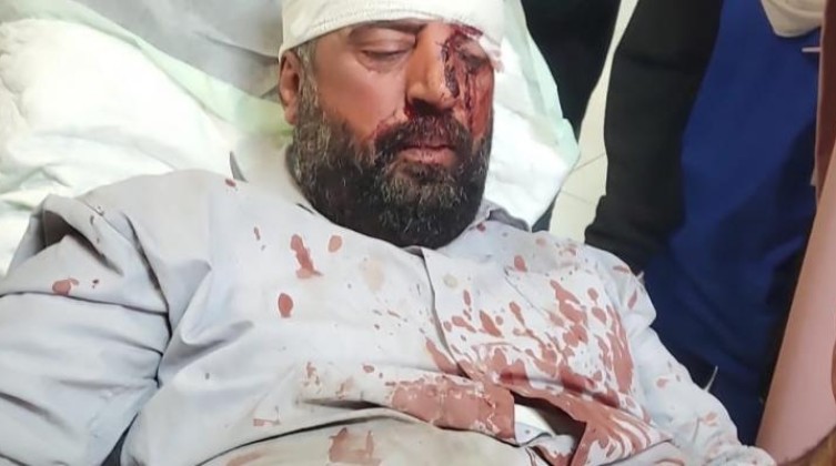 إصابتان جراء اعتداء المستوطنين عليهم في نابلس