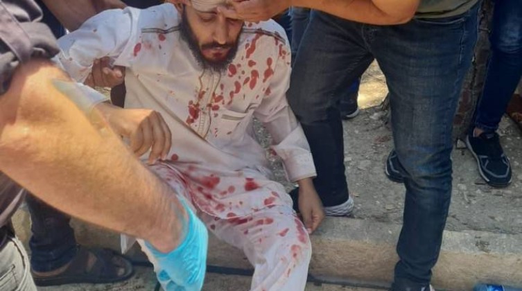 إصابات خلال اعتداء الاحتلال على المصلين عند باب الأسباط بالقدس