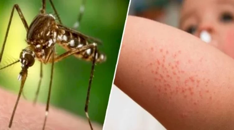 وفاة 7 إسرائيليين بفيروس حمى غرب النيل