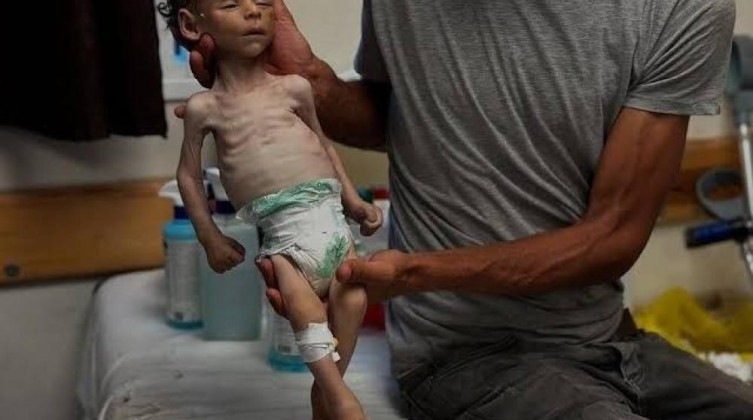 أونروا: المجاعة تفتك بغزة والبحث عن الطعام أصبح مميتًا