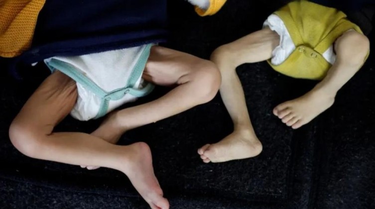 **وفاتان جديدتان بالمجاعة في غزة وارتفاع الحصيلة إلى 113**