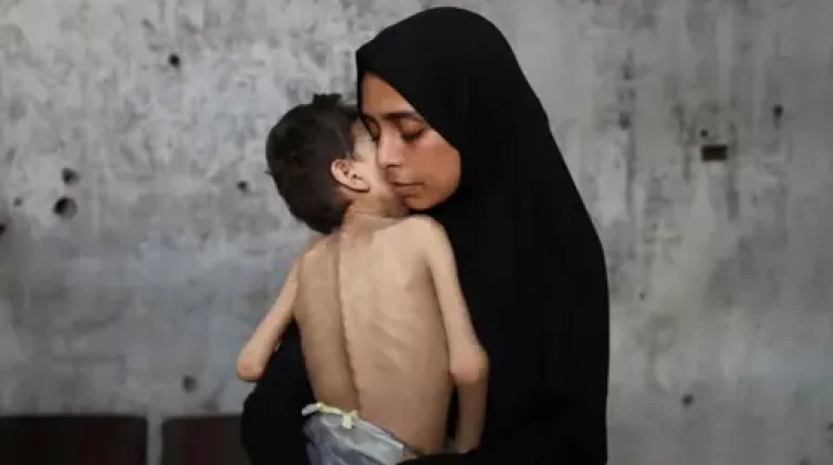 الأمم المتحدة: ثلث سكان قطاع غزة لا يأكلون لأيام