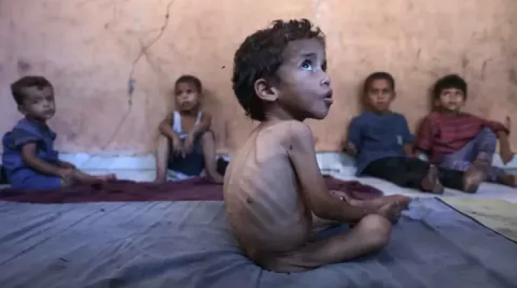 ارتفاع عدد ضحايا الجوع في قطاع غزة