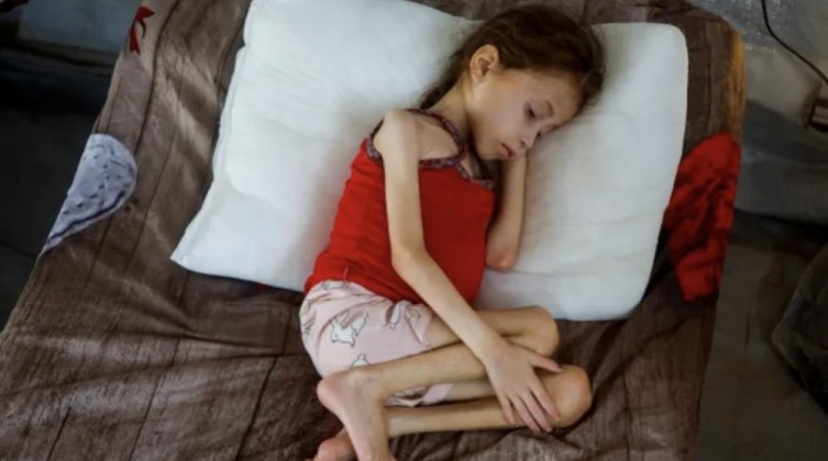 مقرر أممي: إسرائيل تتعمد تجويع غزة وترتكب إبادة جماعية