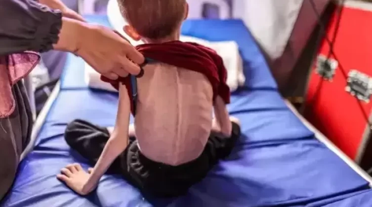 6 وفيات جراء المجاعة في غزة خلال 24 ساعة
