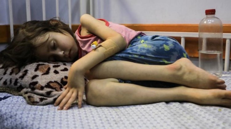 3 وفيات جديدة بسوء التغذية في غزة