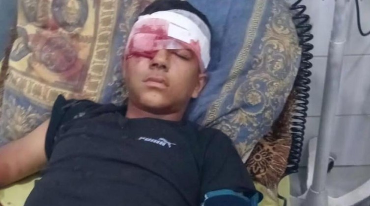 إصابة طفل بجراح خطيرة باقتحام الاحتلال بلدة بيت عوا بالخليل