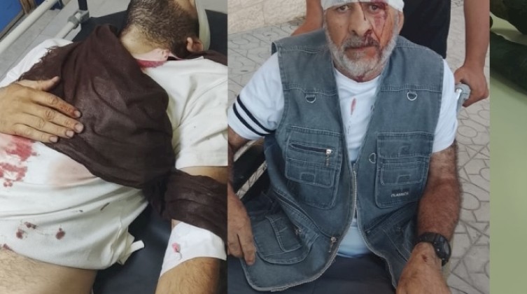 3 إصابات في هجوم للمستوطنين ببلدة يطا جنوب الخليل